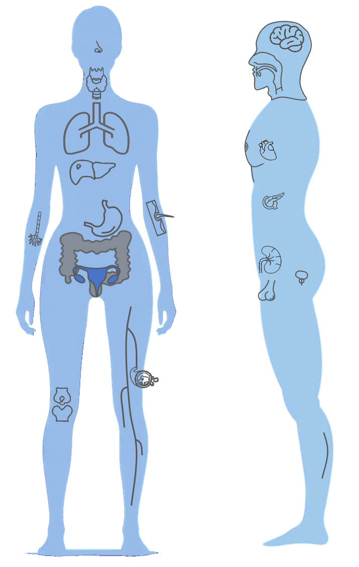 Body Map